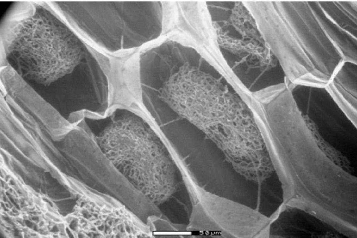 Bundles of fungi (pelotons) inside orchid tissue. Caladenia huegelii showing bundles of fungi (pelotons) inside orchid tissue